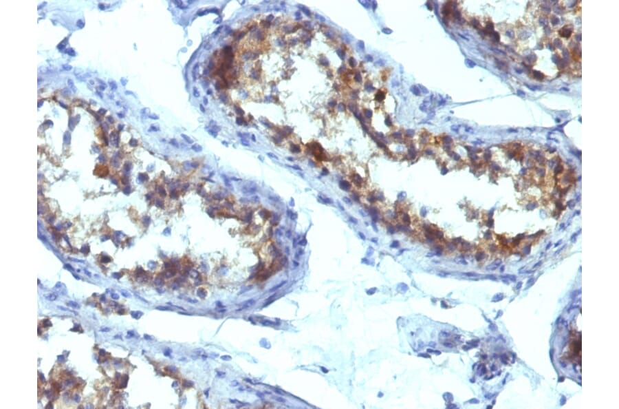 Immunohistochemistry - Anti-Alkaline Phosphatase, Tissue Non-Specific Antibody [ALPL/597] (A248636) - Antibodies.com