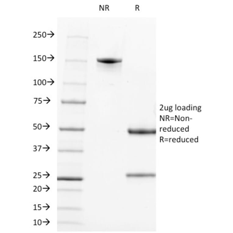 SDS-PAGE - Anti-Alkaline Phosphatase, Tissue Non-Specific Antibody [ALPL/597] (A248636) - Antibodies.com