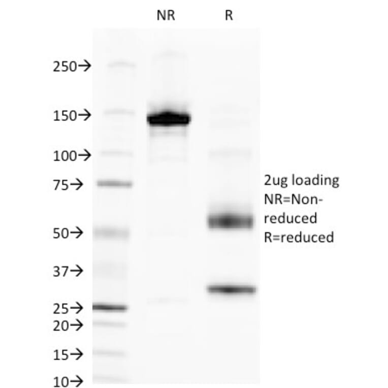 SDS-PAGE - Anti-Alkaline Phosphatase, Tissue Non-Specific Antibody [V17.1] (A248637) - Antibodies.com
