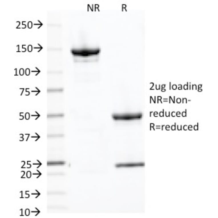 SDS-PAGE - Anti-Placental Alkaline Phosphatase Antibody [ALP/870] (A248639) - Antibodies.com