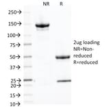 SDS-PAGE - Anti-Placental Alkaline Phosphatase Antibody [ALP/870] (A248639) - Antibodies.com