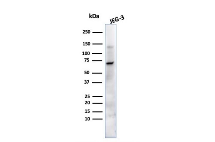 Western Blot - Anti-Placental Alkaline Phosphatase Antibody [ALP/870] (A248639) - Antibodies.com