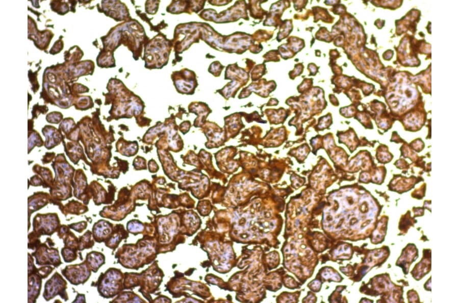 Immunohistochemistry - Anti-Placental Alkaline Phosphatase Antibody [SPM593] (A248639) - Antibodies.com