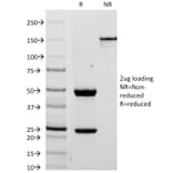 SDS-PAGE - Anti-Placental Alkaline Phosphatase Antibody [ALPP/238] (A248640) - Antibodies.com
