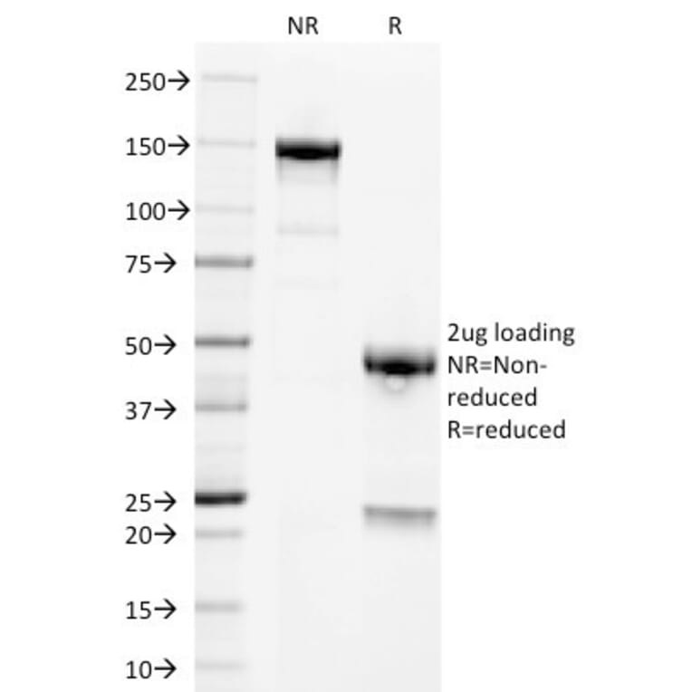 SDS-PAGE - Anti-Placental Alkaline Phosphatase Antibody [GM022] (A248643) - Antibodies.com