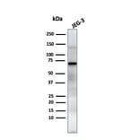 Western Blot - Anti-Placental Alkaline Phosphatase Antibody [GM022] (A248643) - Antibodies.com