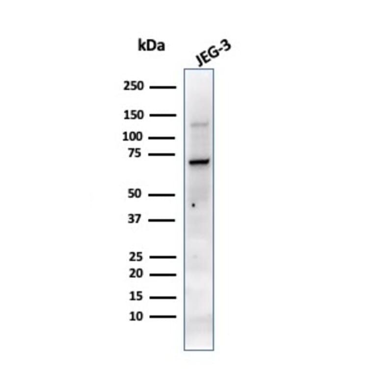 Western Blot - Anti-Placental Alkaline Phosphatase Antibody [PL8-F6] (A248644) - Antibodies.com