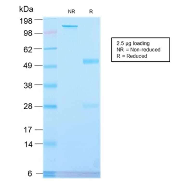 SDS-PAGE - Anti-Placental Alkaline Phosphatase Antibody [ALPP/2899R] (A248645) - Antibodies.com