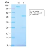 SDS-PAGE - Anti-Placental Alkaline Phosphatase Antibody [ALPP/2899R] (A248645) - Antibodies.com