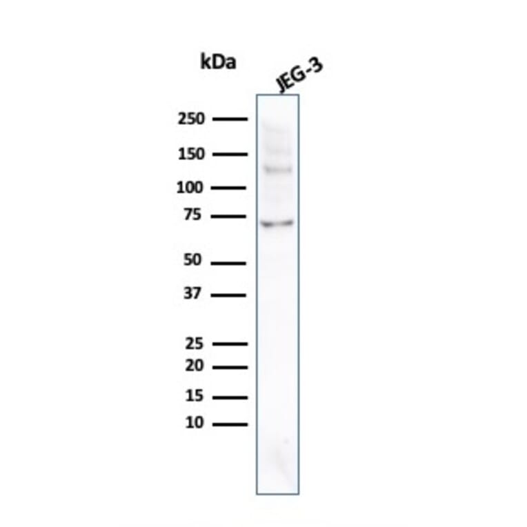 Western Blot - Anti-Placental Alkaline Phosphatase Antibody [ALPP/2899R] (A248645) - Antibodies.com