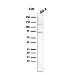 Western Blot - Anti-Placental Alkaline Phosphatase Antibody [ALPP/2899R] (A248645) - Antibodies.com