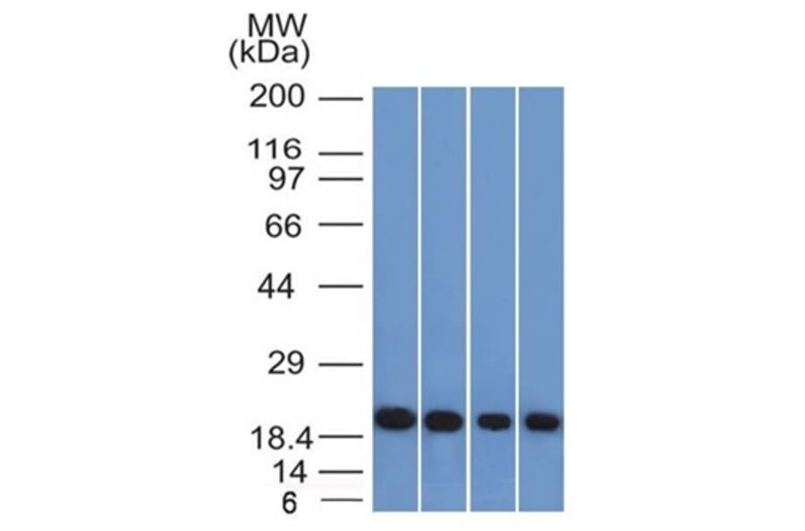 Western Blot - Anti-Ferritin Light Chain Antibody [FTL/1386] (A248646) - Antibodies.com