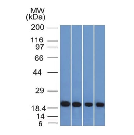Western Blot - Anti-Ferritin Light Chain Antibody [FTL/1386] (A248646) - Antibodies.com