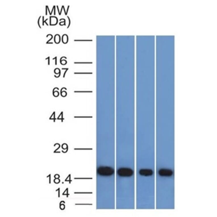 Western Blot - Anti-Ferritin Light Chain Antibody [FTL/1386] (A248646) - Antibodies.com