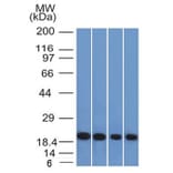 Western Blot - Anti-Ferritin Light Chain Antibody [FTL/1386] (A248646) - Antibodies.com