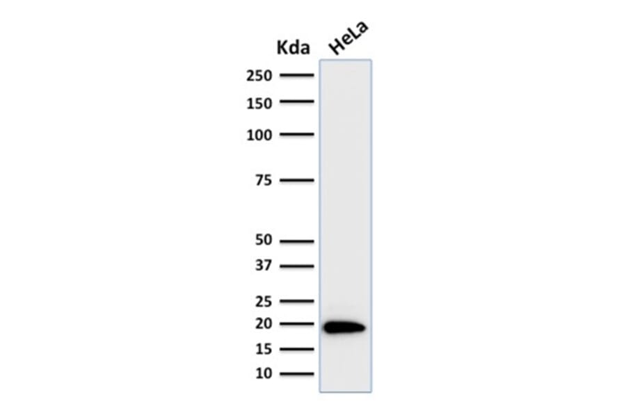 Western Blot - Anti-Ferritin Light Chain Antibody [FTL/1386] (A248646) - Antibodies.com