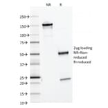 SDS-PAGE - Anti-Ferritin Light Chain Antibody [FTL/1386] (A248646) - Antibodies.com