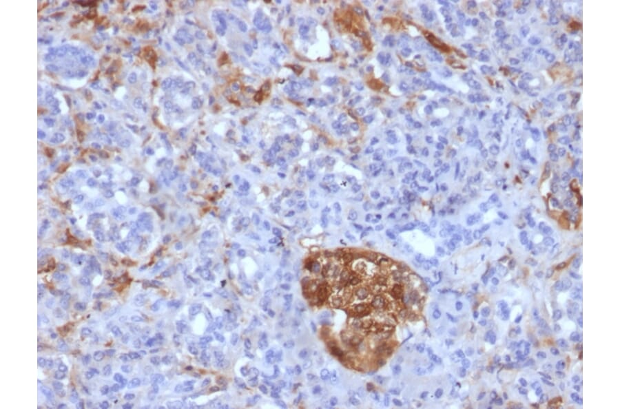 Immunohistochemistry - Anti-Ferritin Light Chain Antibody [FTL/1386] (A248646) - Antibodies.com
