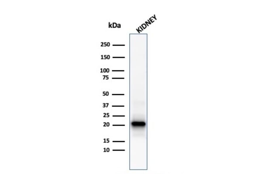 Western Blot - Anti-Ferritin Light Chain Antibody [FTL/1386] (A248646) - Antibodies.com