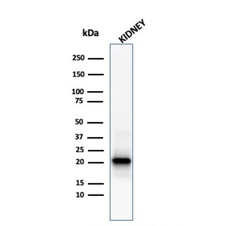Western Blot - Anti-Ferritin Light Chain Antibody [FTL/1386] (A248646) - Antibodies.com