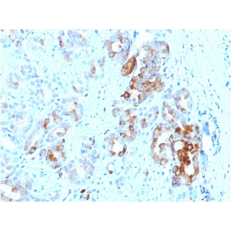 Immunohistochemistry - Anti-Ferritin Light Chain Antibody [FTL/1387] (A248647) - Antibodies.com