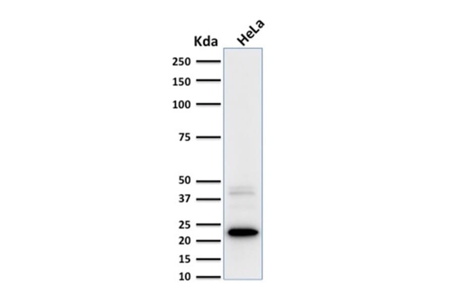 Western Blot - Anti-Ferritin Light Chain Antibody [FTL/1387] (A248647) - Antibodies.com