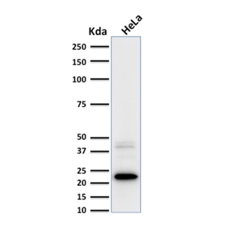 Western Blot - Anti-Ferritin Light Chain Antibody [FTL/1387] (A248647) - Antibodies.com