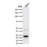 Western Blot - Anti-Ferritin Light Chain Antibody [FTL/1387] (A248647) - Antibodies.com