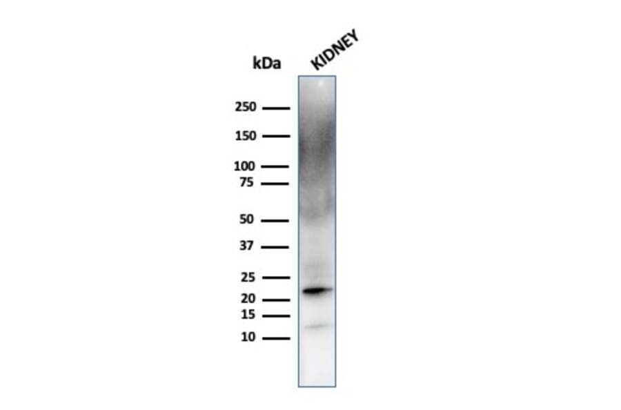 Western Blot - Anti-Ferritin Light Chain Antibody [FTL/1387] (A248647) - Antibodies.com