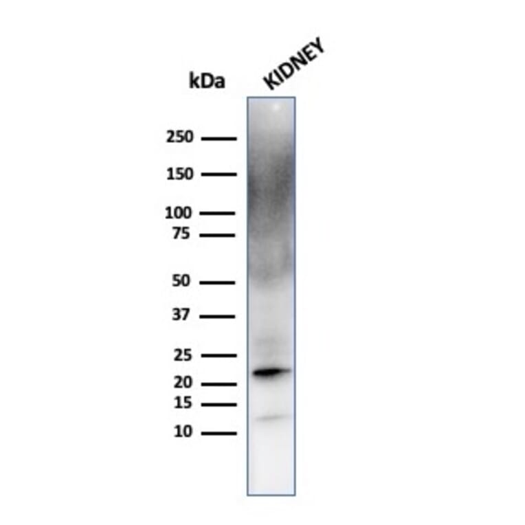 Western Blot - Anti-Ferritin Light Chain Antibody [FTL/1387] (A248647) - Antibodies.com