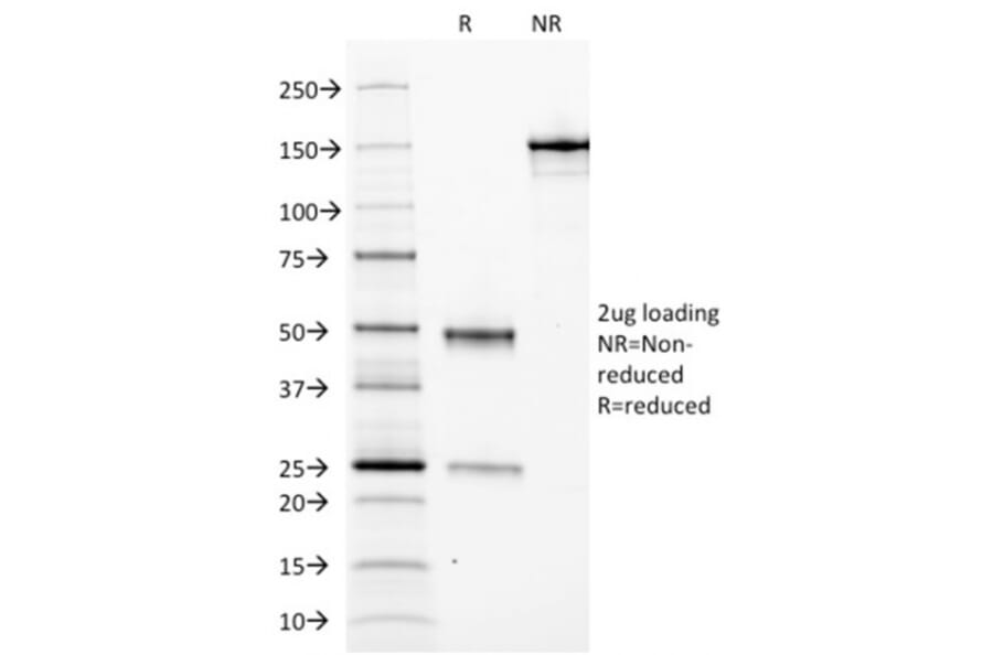 SDS-PAGE - Anti-Ferritin Light Chain Antibody [FTL/1388] (A248648) - Antibodies.com