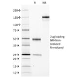 SDS-PAGE - Anti-Ferritin Light Chain Antibody [FTL/1388] (A248648) - Antibodies.com