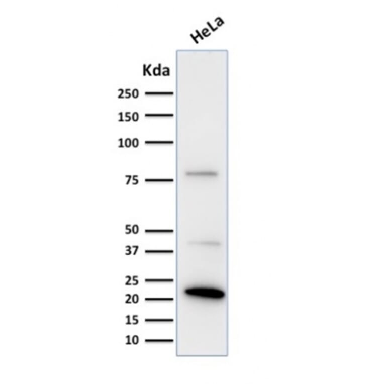 Western Blot - Anti-Ferritin Light Chain Antibody [FTL/1388] (A248648) - Antibodies.com