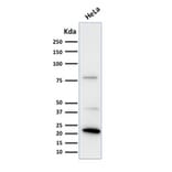 Western Blot - Anti-Ferritin Light Chain Antibody [FTL/1388] (A248648) - Antibodies.com