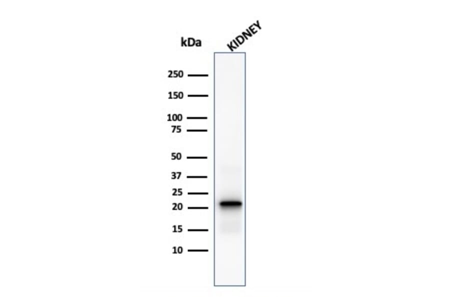 Western Blot - Anti-Ferritin Light Chain Antibody [FTL/1388] (A248648) - Antibodies.com