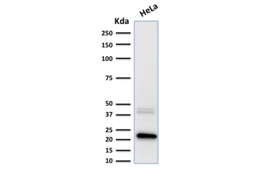 Western Blot - Anti-Ferritin Light Chain Antibody [FTL/1389] (A248649) - Antibodies.com