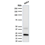 Western Blot - Anti-Ferritin Light Chain Antibody [FTL/1389] (A248649) - Antibodies.com