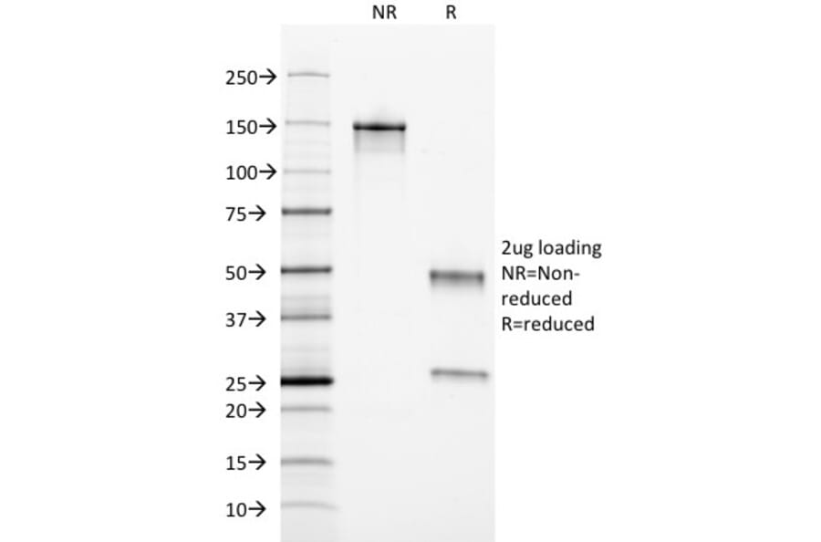 SDS-PAGE - Anti-Ferritin Light Chain Antibody [FTL/1389] (A248649) - Antibodies.com