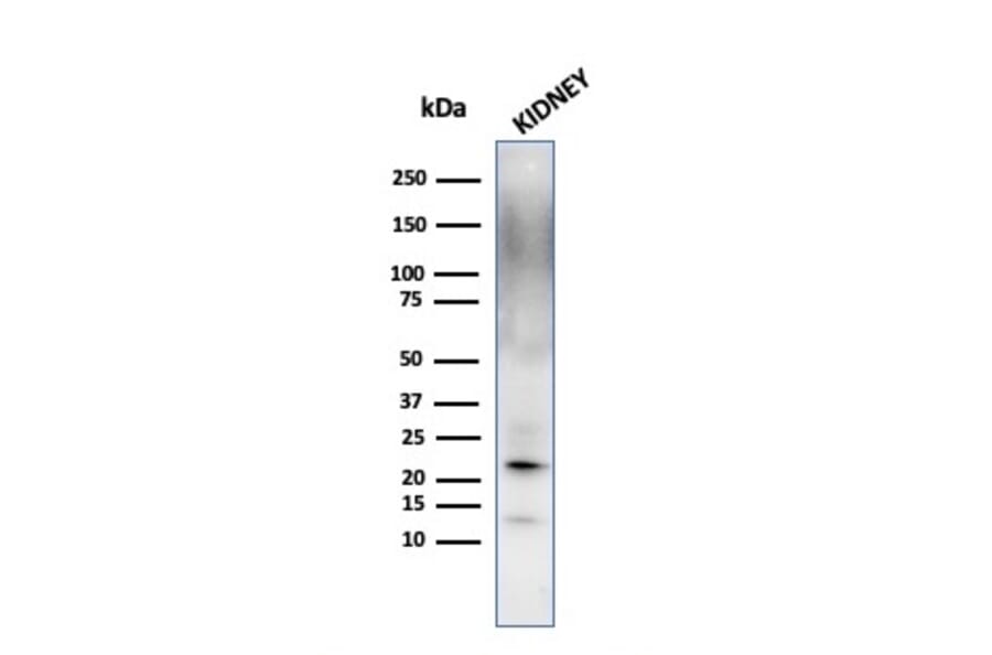 Western Blot - Anti-Ferritin Light Chain Antibody [FTL/1389] (A248649) - Antibodies.com