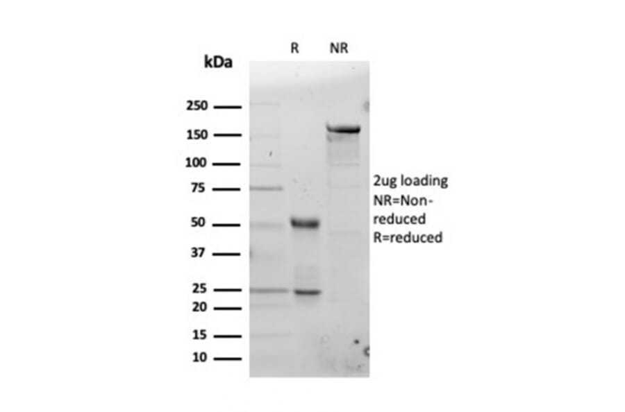 SDS-PAGE - Anti-Ferritin Light Chain Antibody [FTL/3100] (A248650) - Antibodies.com