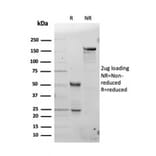 SDS-PAGE - Anti-Ferritin Light Chain Antibody [FTL/3100] (A248650) - Antibodies.com