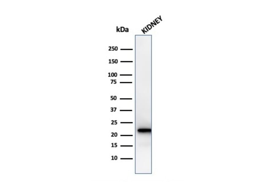 Western Blot - Anti-Ferritin Light Chain Antibody [rFTL/1388] (A248651) - Antibodies.com