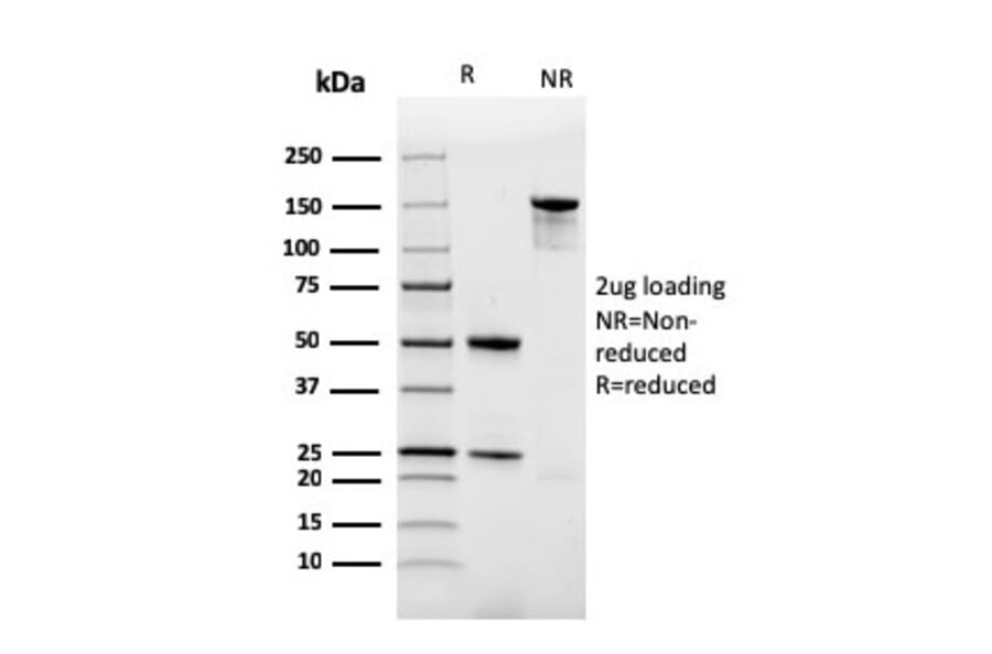 SDS-PAGE - Anti-Ferritin Light Chain Antibody [rFTL/1386] (A248652) - Antibodies.com