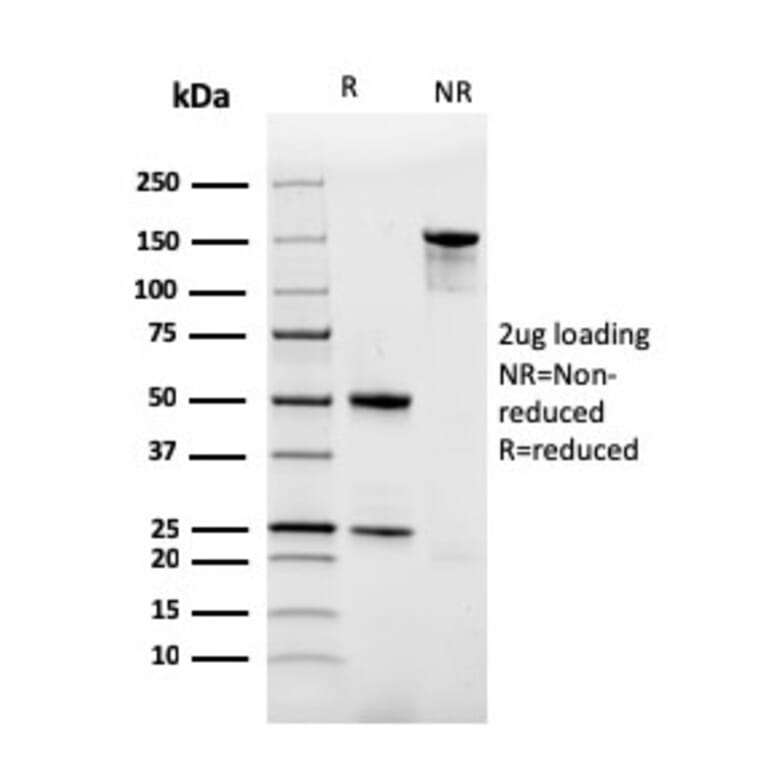 SDS-PAGE - Anti-Ferritin Light Chain Antibody [rFTL/1386] (A248652) - Antibodies.com