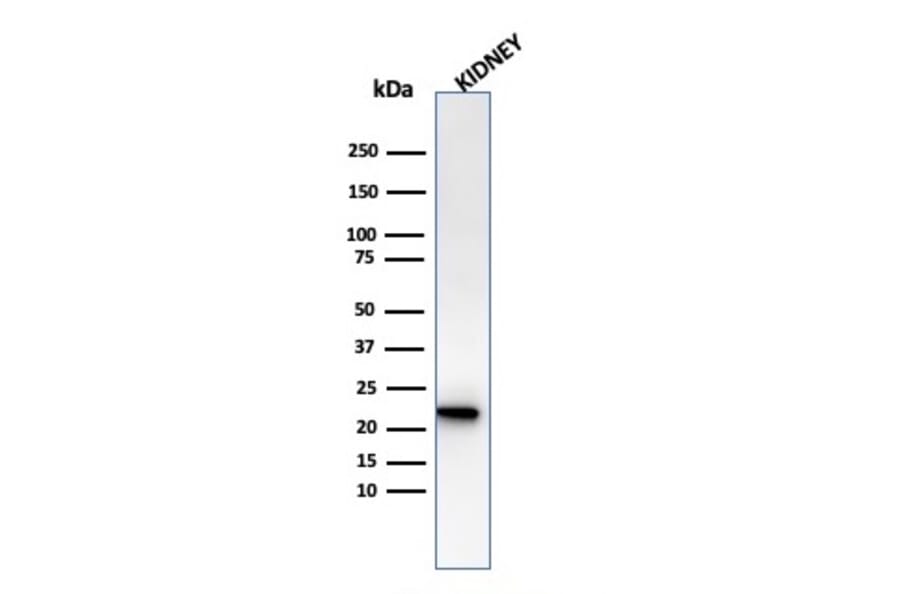 Western Blot - Anti-Ferritin Light Chain Antibody [rFTL/1386] (A248652) - Antibodies.com