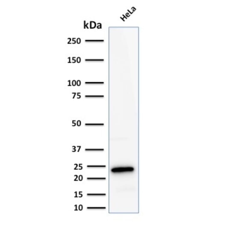 Western Blot - Anti-Ferritin Light Chain Antibody [FTL/2338R] (A248653) - Antibodies.com