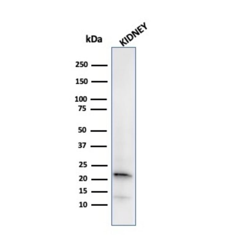 Western Blot - Anti-Ferritin Light Chain Antibody [FTL/2338R] (A248653) - Antibodies.com