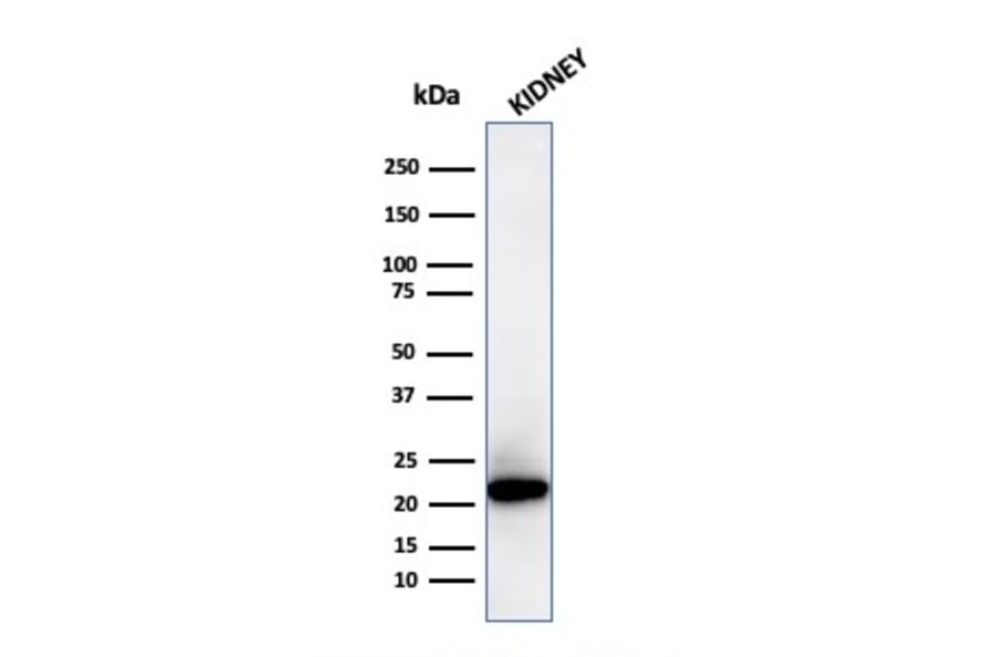 Western Blot - Anti-Ferritin Light Chain Antibody [FTL/3872R] (A248654) - Antibodies.com