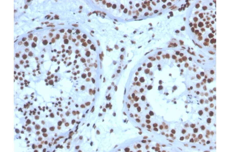 Immunohistochemistry - Anti-Steroidogenic Factor 1 Antibody [NR5A1/3397] (A248655) - Antibodies.com
