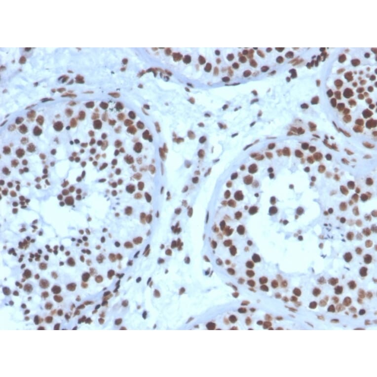 Immunohistochemistry - Anti-Steroidogenic Factor 1 Antibody [NR5A1/3397] (A248655) - Antibodies.com